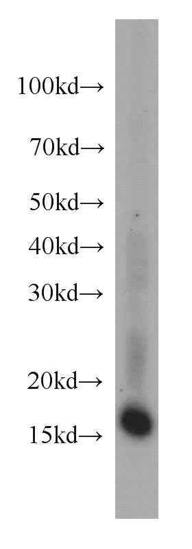 HepG2 cells were subjected to SDS PAGE followed by western blot with Catalog No:114007(PLP2 antibody) at dilution of 1:500