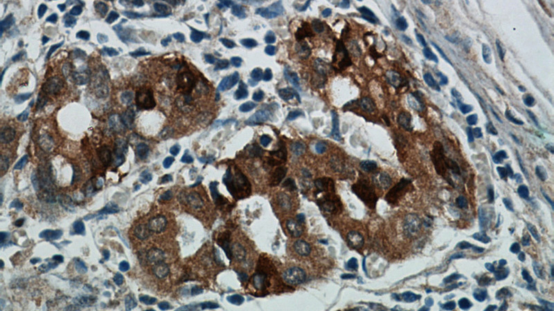 Immunohistochemical of paraffin-embedded human stomach using Catalog No:109226(CHIA antibody) at dilution of 1:50 (under 40x lens)
