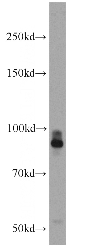 HeLa cells were subjected to SDS PAGE followed by western blot with Catalog No:114330(rPTPσ antibody) at dilution of 1:1000