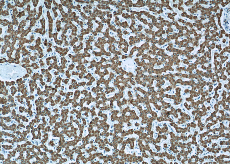 Immunohistochemical of paraffin-embedded human liver using Catalog No:107971(ALDH4A1 antibody) at dilution of 1:100 (under 10x lens)