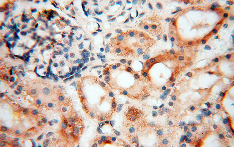 Immunohistochemical of paraffin-embedded human kidney using Catalog No:116598(USP20 antibody) at dilution of 1:50 (under 40x lens)