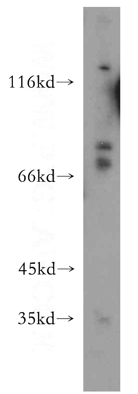 mouse thymus tissue were subjected to SDS PAGE followed by western blot with Catalog No:117081(AXUD1 antibody) at dilution of 1:500