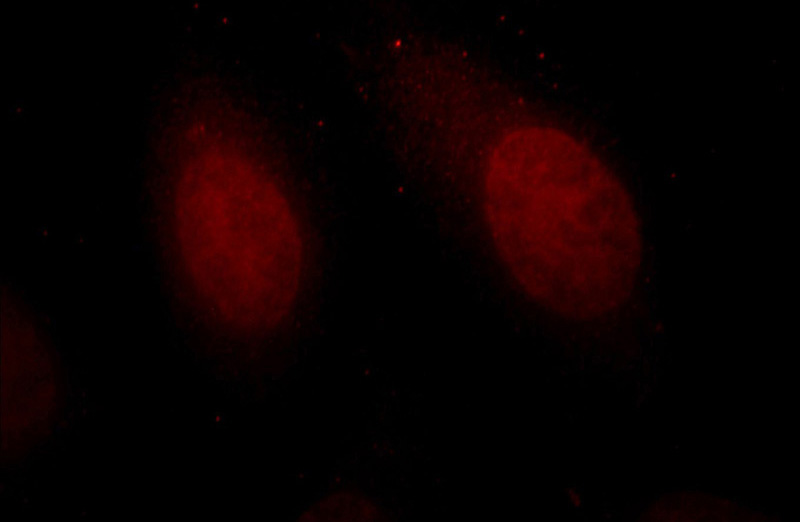 Immunofluorescent analysis of HepG2 cells, using HMG20A antibody Catalog No:111475 at 1:25 dilution and Rhodamine-labeled goat anti-rabbit IgG (red).