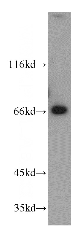 mouse brain tissue were subjected to SDS PAGE followed by western blot with Catalog No:112420(LZTS1 antibody) at dilution of 1:500
