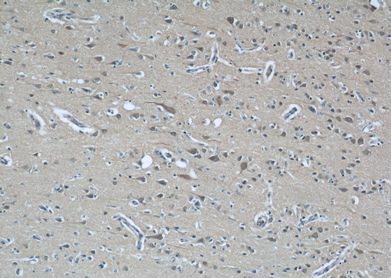 Immunohistochemical of paraffin-embedded human brain using Catalog No:108822(CALHM1 antibody) at dilution of 1:50 (under 10x lens)
