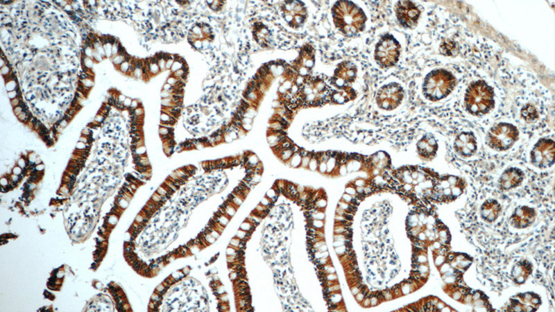 Immunohistochemistry of paraffin-embedded human small intestine tissue slide using Catalog No:113212(NPFFR2 Antibody) at dilution of 1:50 (under 10x lens)