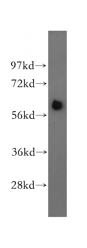 HeLa cells were subjected to SDS PAGE followed by western blot with Catalog No:115894(TBX6 antibody) at dilution of 1:800