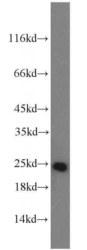 HEK-293 cells were subjected to SDS PAGE followed by western blot with Catalog No:113435(ATP5O antibody) at dilution of 1:1000