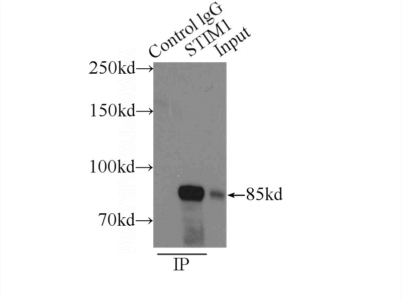 IP Result of anti-STIM1 (IP:Catalog No:115707, 3ug; Detection:Catalog No:115707 1:1000) with Raji cells lysate 3800ug.