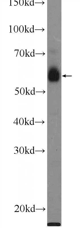 HeLa cells were subjected to SDS PAGE followed by western blot with Catalog No:108684(C1orf92 Antibody) at dilution of 1:300