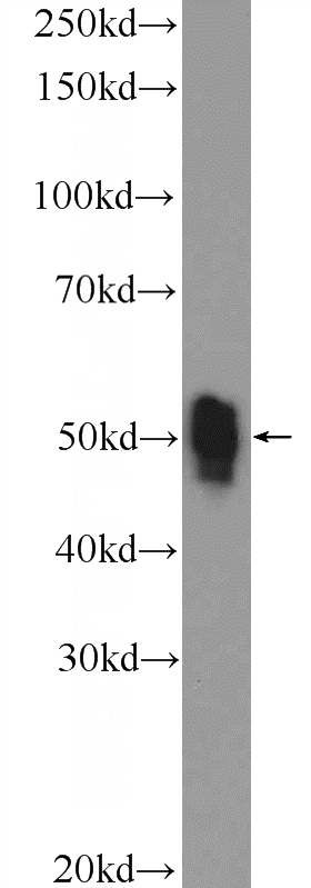 Jurkat cells were subjected to SDS PAGE followed by western blot with Catalog No:110486(ETS1 Antibody) at dilution of 1:600