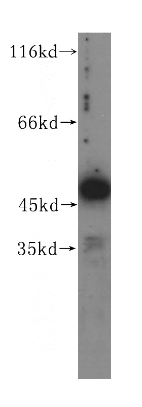 HepG2 cells were subjected to SDS PAGE followed by western blot with Catalog No:112267(LAD1 antibody) at dilution of 1:400