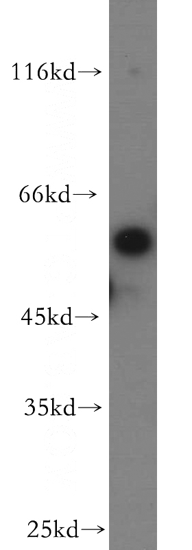 HeLa cells were subjected to SDS PAGE followed by western blot with Catalog No:114855(C22orf28 antibody) at dilution of 1:500