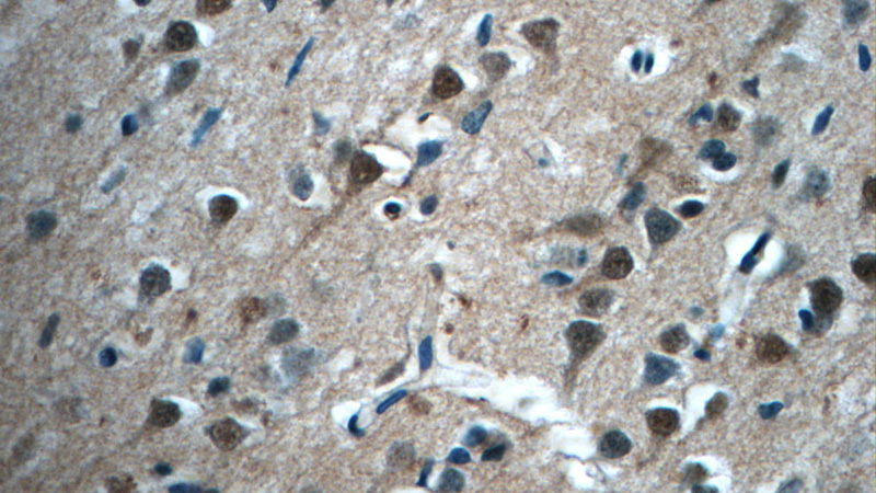 Immunohistochemistry of paraffin-embedded human brain tissue slide using Catalog No:110554(FBXO41 Antibody) at dilution of 1:50 (under 40x lens)