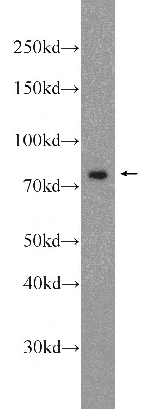 Jurkat cells were subjected to SDS PAGE followed by western blot with Catalog No:115498(SESTD1 Antibody) at dilution of 1:1000