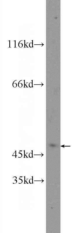 HeLa cells were subjected to SDS PAGE followed by western blot with Catalog No:112487(MASP1 Antibody) at dilution of 1:300