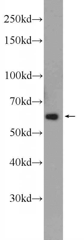 Jurkat cells were subjected to SDS PAGE followed by western blot with Catalog No:116895(YTHDF2 Antibody) at dilution of 1:1000