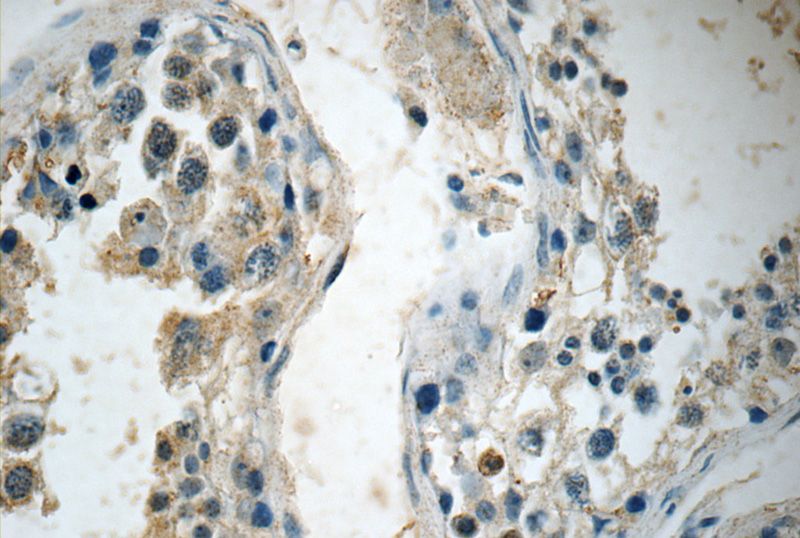 Immunohistochemistry of paraffin-embedded human testis tissue slide using Catalog No:107859(ALKBH7 Antibody) at dilution of 1:50 (under 40x lens)