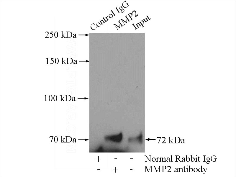 IP Result of anti-MMP2 (IP:Catalog No:112700, 4ug; Detection:Catalog No:112700 1:300) with NIH/3T3 cells lysate 1200ug.