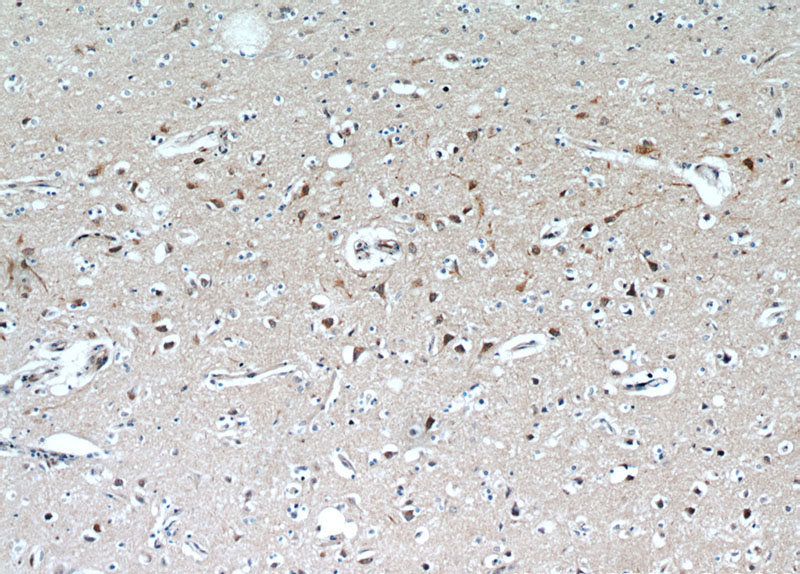Immunohistochemical of paraffin-embedded human brain using Catalog No:109513(CPLX4 antibody) at dilution of 1:100 (under 10x lens)