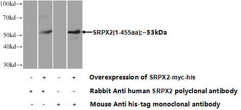 Transfected HEK-293 cells were subjected to SDS PAGE followed by western blot with Catalog No:115599(SRPX2 Antibody) at dilution of 1:1000