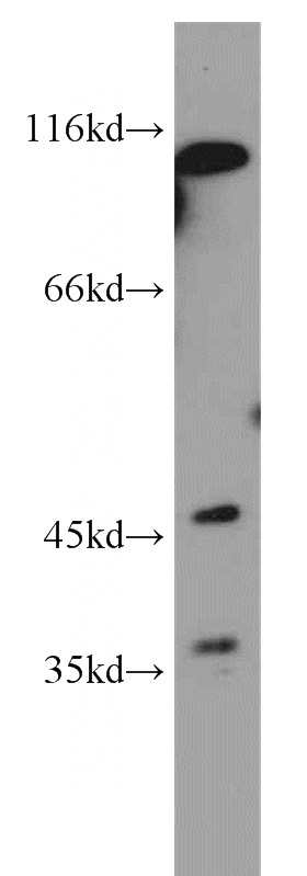 MCF7 cells were subjected to SDS PAGE followed by western blot with Catalog No:112533(MFSD7 antibody) at dilution of 1:400