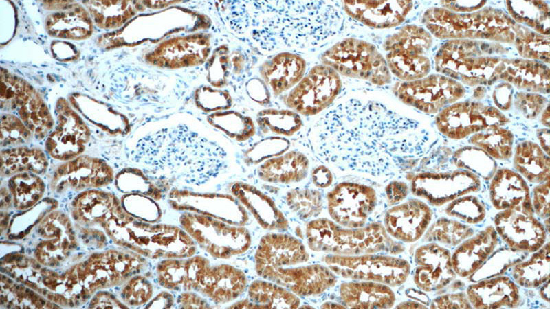 Immunohistochemistry of paraffin-embedded human kidney tissue slide using Catalog No:116095(TMEM120B Antibody) at dilution of 1:50 (under 10x lens)