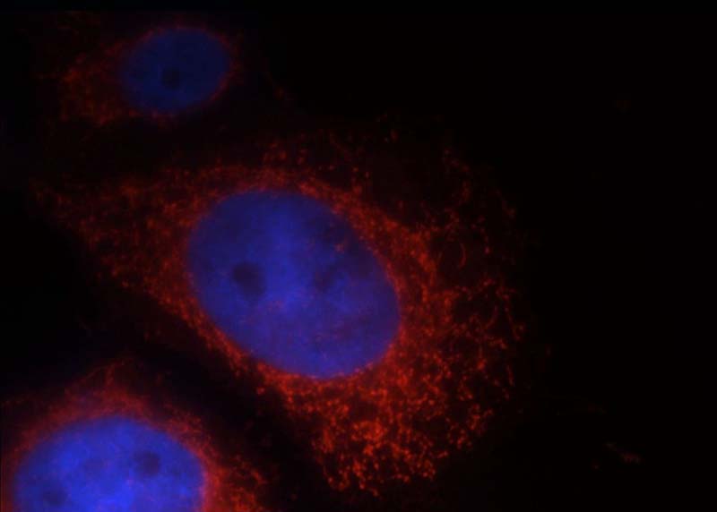 Immunofluorescent analysis of Hela cells, using LRDD antibody Catalog No:112317 at 1:25 dilution and Rhodamine-labeled goat anti-rabbit IgG (red). Blue pseudocolor = DAPI (fluorescent DNA dye).