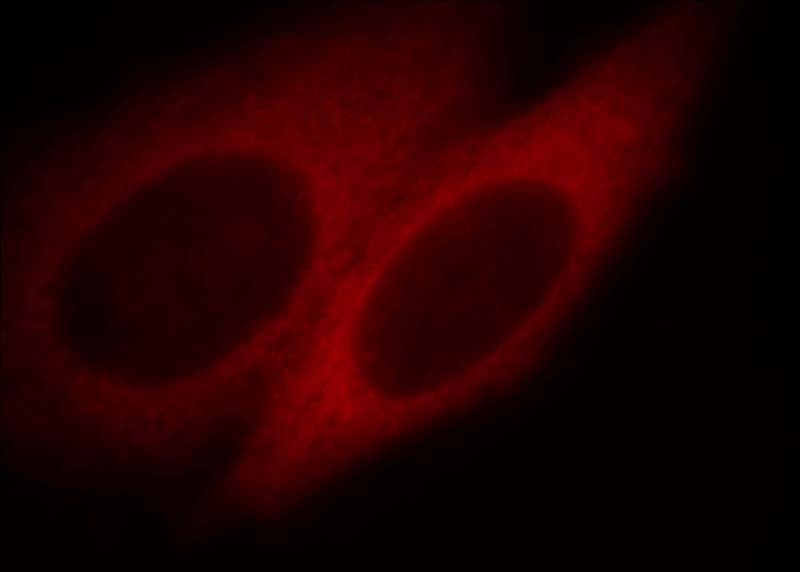 Immunofluorescent analysis of HepG2 cells, using SLK antibody Catalog No:115361 at 1:25 dilution and Rhodamine-labeled goat anti-rabbit IgG (red).