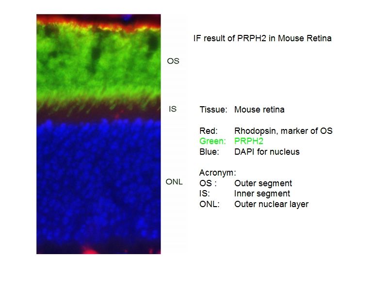 IF result of anti-PRPH2(Catalog No:114236) in Mouse Retina by Dr. Seongjin Seo. OS(Outer segment) Stain.