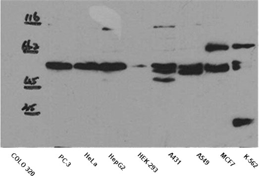WB result of anti-SMAD2 (Catalog No:115416) in different cell lysates.