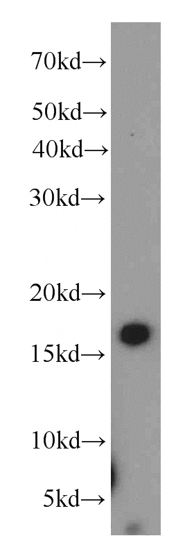 human colon tissue were subjected to SDS PAGE followed by western blot with Catalog No:117049(ZG16 antibody) at dilution of 1:500