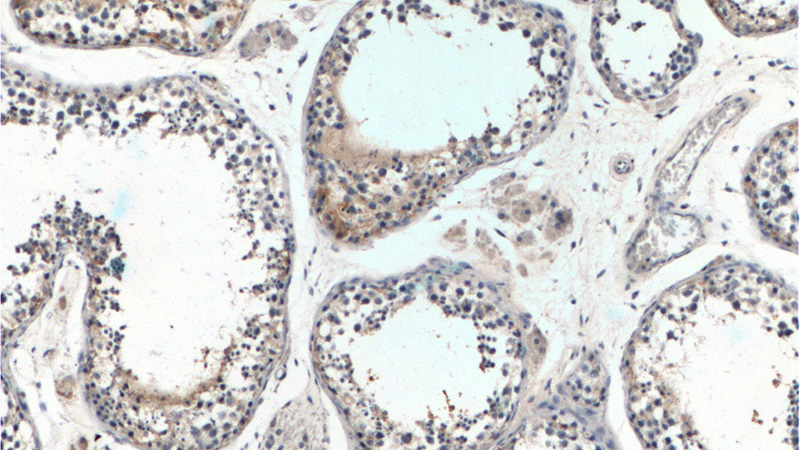 Immunohistochemistry of paraffin-embedded human testis tissue slide using Catalog No:109912(DGKH Antibody) at dilution of 1:200 (under 10x lens).