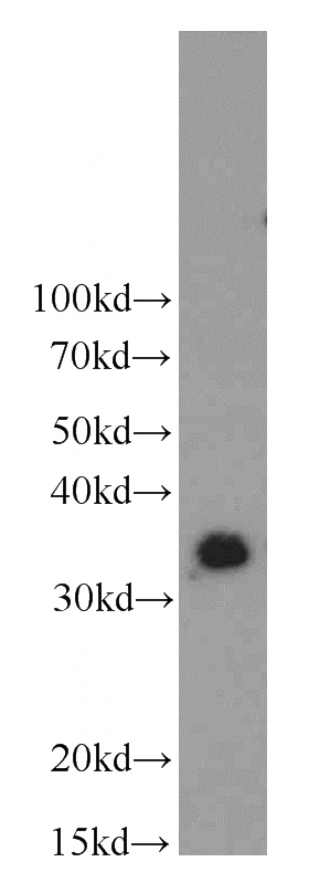 Y79 cells were subjected to SDS PAGE followed by western blot with Catalog No:112503(MBD3 antibody) at dilution of 1:600