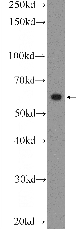 A431 cells were subjected to SDS PAGE followed by western blot with Catalog No:109607(c-SRC Antibody) at dilution of 1:1000