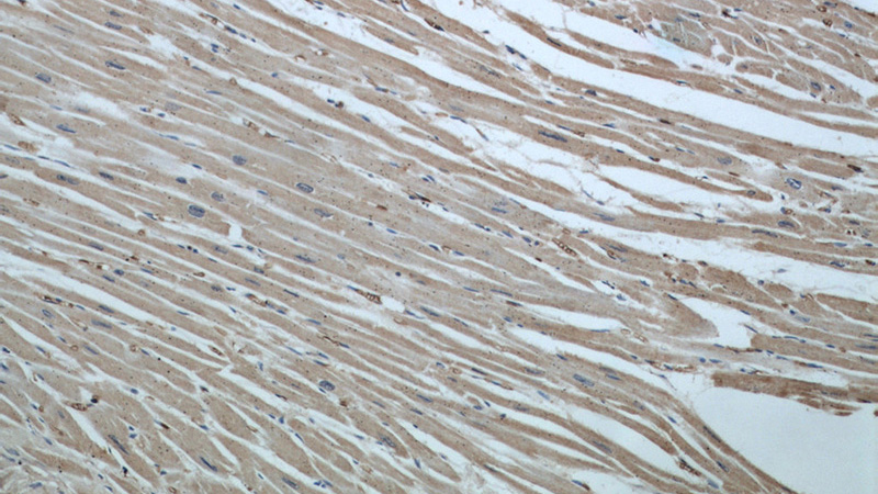 Immunohistochemical of paraffin-embedded human heart using Catalog No:113001(MYPT1 antibody) at dilution of 1:50 (under 10x lens)