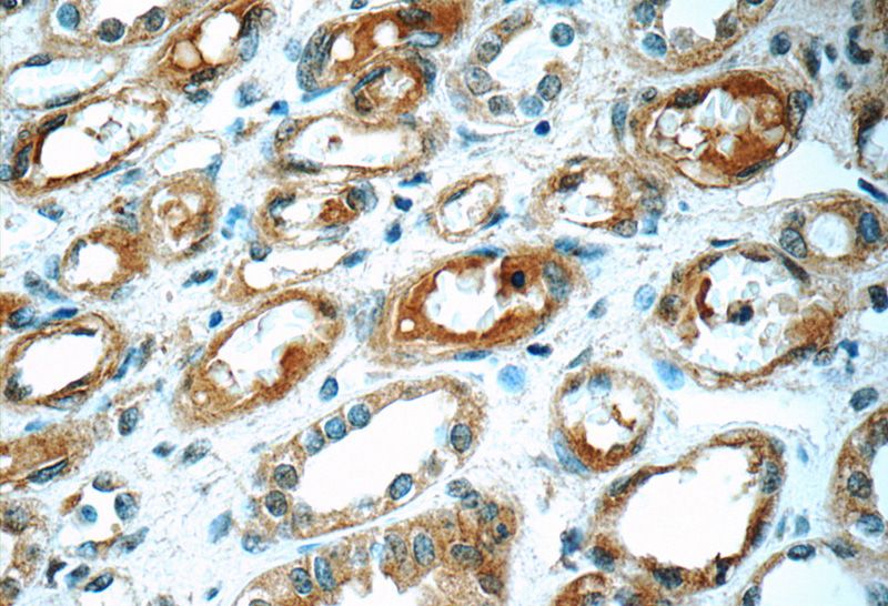 Immunohistochemistry of paraffin-embedded human kidney tissue slide using Catalog No:111618(IFIT1L Antibody) at dilution of 1:50 (under 40x lens)