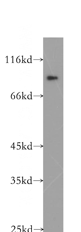 K-562 cells were subjected to SDS PAGE followed by western blot with Catalog No:113938(PKP3 antibody) at dilution of 1:600