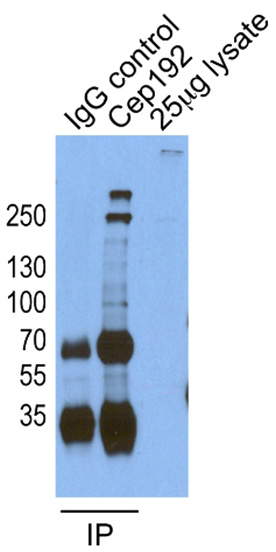 IP result of anti-CEP192 (Catalog No:109269 for IP and Detection) with HeLa cells.