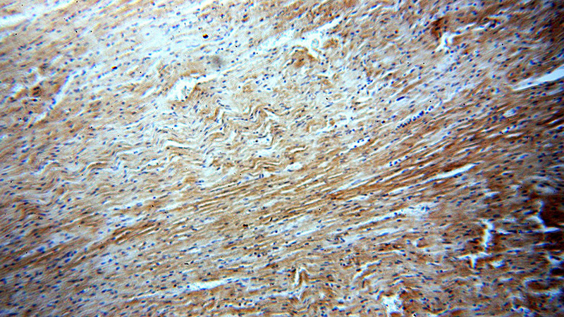 Immunohistochemical of paraffin-embedded human heart using Catalog No:108297(ATG4C antibody) at dilution of 1:50 (under 10x lens)
