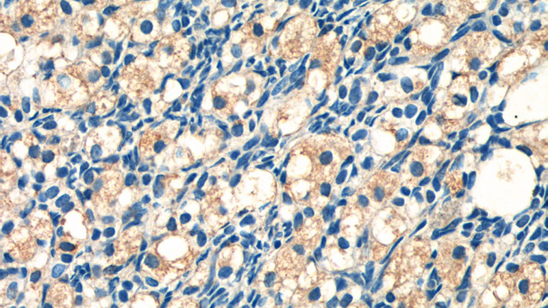 Immunohistochemistry of paraffin-embedded human ovary tissue slide using Catalog No:108334(ATN1 Antibody) at dilution of 1:50 (under 40x lens)