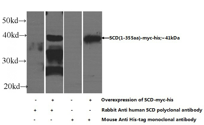 HEK-293 cells were subjected to SDS PAGE followed by western blot with Catalog No:114989(SCD Antibody) at dilution of 1:1000