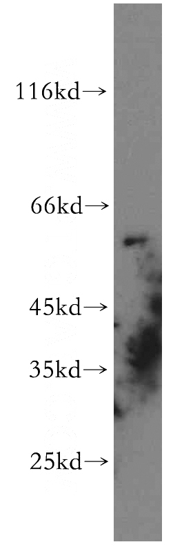 HEK-293 cells were subjected to SDS PAGE followed by western blot with Catalog No:111069(GPR101-Specific antibody) at dilution of 1:300