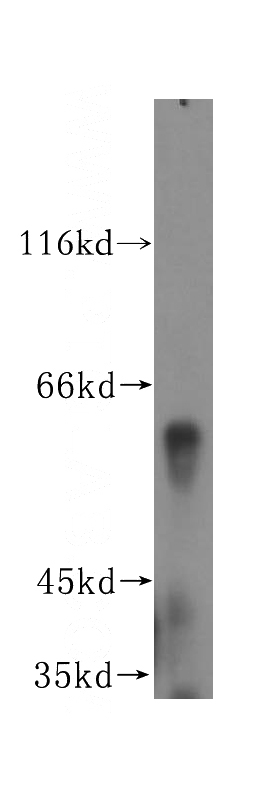 human brain tissue were subjected to SDS PAGE followed by western blot with Catalog No:109759(DCTN4 antibody) at dilution of 1:800