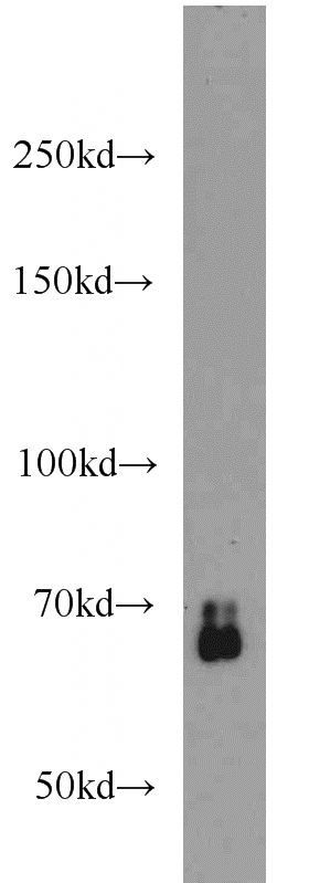 HEK-293 cells were subjected to SDS PAGE followed by western blot with Catalog No:115418(SMAD4 antibody) at dilution of 1:600
