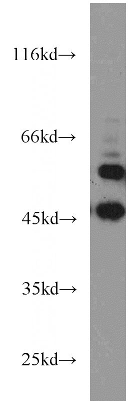 HEK-293 cells were subjected to SDS PAGE followed by western blot with Catalog No:108911(CALU antibody) at dilution of 1:800