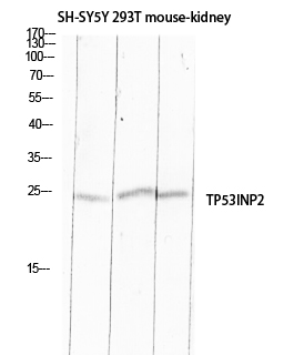 Fig1:; Western blot analysis of SH-SY5Y 293T mouse-kidney lysis using TP53INP2 antibody. Antibody was diluted at 1:500. Secondary antibody（catalog#: HA1001) was diluted at 1:20000 cells nucleus extracted by Minute TM Cytoplasmic and Nuclear Fractionation kit (SC-003,Inventbiotech,MN,USA).