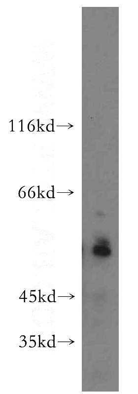 K-562 cells were subjected to SDS PAGE followed by western blot with Catalog No:116604(USP3 antibody) at dilution of 1:500