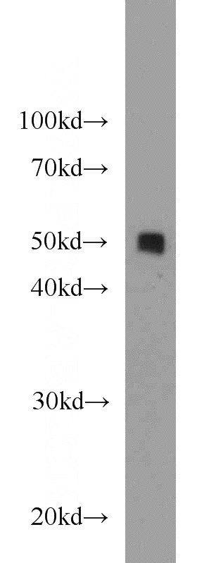 HEK-293 cells were subjected to SDS PAGE followed by western blot with Catalog No:113682(PDIA6 antibody) at dilution of 1:2000