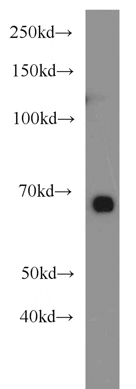 HeLa cells were subjected to SDS PAGE followed by western blot with Catalog No:110879(GATA2 antibody) at dilution of 1:300
